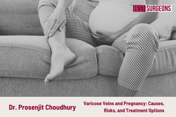 Varicose Veins and the Pregnant Woman: Understanding the Relation, Risk Factors, and Treatment